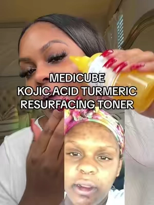 ✨💛 Kojic Acid Turmeric Resurfacing toner @medicube global #turmeric #kojicacid #toner #hyperpigmentation #tiktokshopblackfriday 