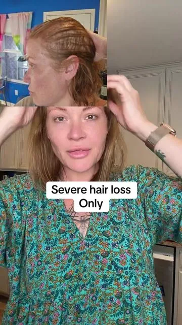 This is coming at your hair from all angles! Hair quality, hair, density hair shedding …  always ask your doctor before starting a new supplement and Results may vary. ##hairlosssolutions##hairregrowthtips##maryruthsorganics##bfcm##hairgrowthsupplements 