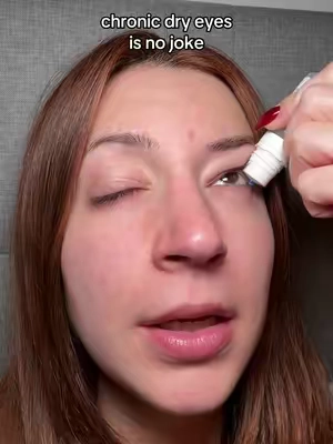 chronic dry eyes is no joke #tears #dryeyes #chronicdryeyes #corneacare #dryeyerelief 
