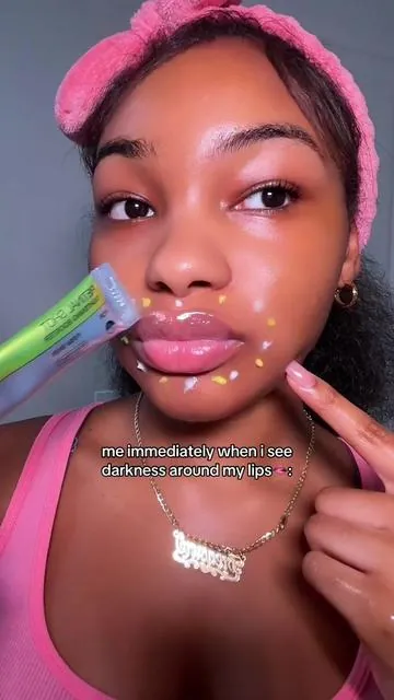 how to get rid of pigmentation around the lips 👄!! AD @celimax.global #lippigmentation #celimaxpartner #fyp 