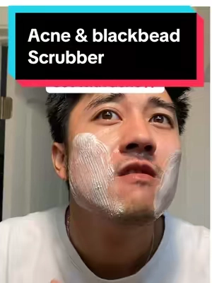 Secret to fixing acne and blackheads  #facialcleanser #sudscrub #exfoliation #exfoliante #glasskin 
