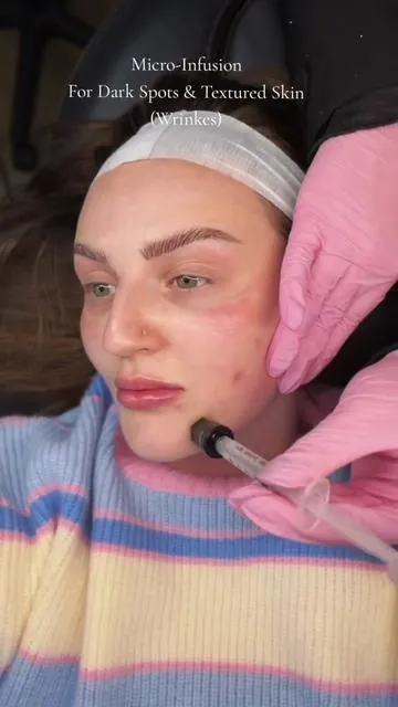 #stitch with @Mikayla Nogueira The best kind of holiday gift? The kind that makes you glow! 🛍️ Don't miss out on getting the Qure favorites everyone is talking about.  Look for pre-holiday specials now!Say goodbye to dull, dry winter skin and hello to an immediate, luminous glow that can last through all your festive events. 🌟  #microinfusion #TTSWest #TiktokshopBlackFriday ##TiktokShopCyberMonday  @Qure Skincare 