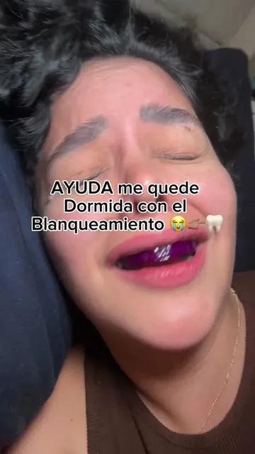 Me dormí 5 horas con Hismile y… estoy en shock 😳🦷 #hismile #whitening #blanqueamientodental #tiktokshopblackfriday #tiktokshopcybermonday 