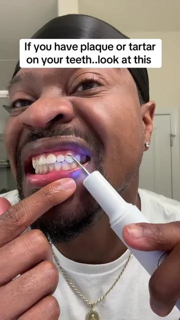 If you have plaque or tartar on your teeth, look into this., it may can help. Results can vary from person to person #teeth #plaque #tartar #teethcare 