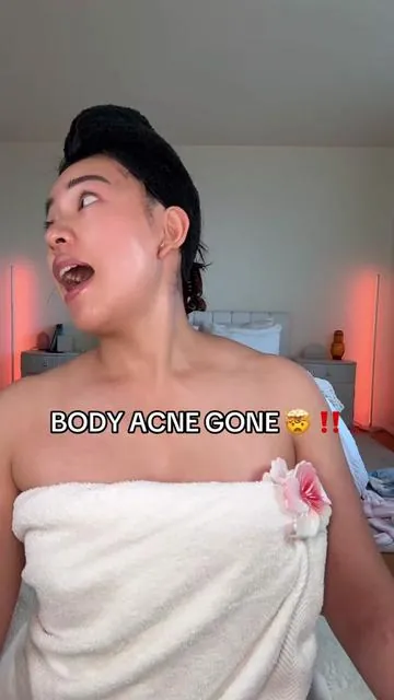 I’ve been using this Some By Mi acne body wash and then the panthenol body repair cream on my back and shoulders because my body acne was getting out of hand 😅 It’s a K-beauty body care routine that’s been helping with bacne, little bumps, and redness, and my skin feels way smoother and less irritated after showers. Just trying to keep my body breakouts and KP under control without using anything too harsh. #bodyacne #kbeauty #somebymi #sundayreset #tiktokshopcreatorpicks 