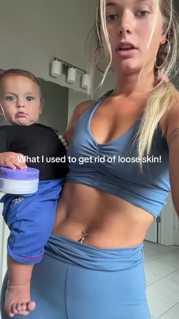 The difference I've seen since using this>>>>😍 im so happy I gave it a chance  IG sunny_daze222  #fyp #viral #postpartum #stretchmarks #pregnancy #ttshop 