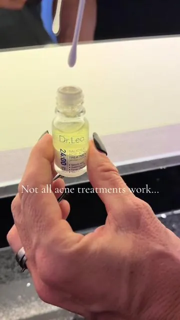 With four daughters we’ve tried everything… but this is the acne treatment that stays on our vanity. Salicylic acid, niacinamide, zinc + sulfur — it’s the one they keep reaching for because it actually helps their skin look calm and clear. Check the orange cart to see if it’s still available. 🤍✨ @Dr.Leo-USA #d#drleos#skincareforkidst#teenacnes#salicylicacidskincareroutine 