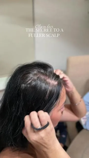 Ohhh these are a life savor for post partum hairloss!!! Hairloss in general 🙏 @WENNALIFE  #hairloss #wennalife #wennahair #hairfillers #thickerhair 