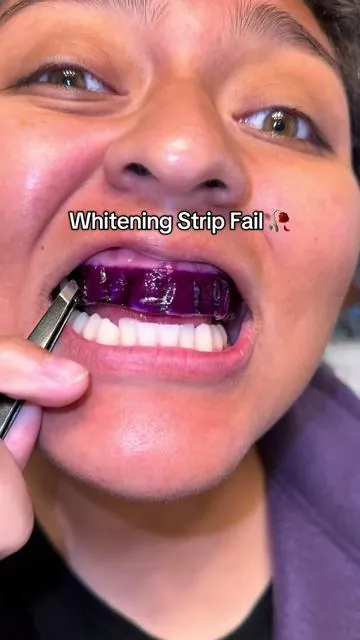 Now I understand 😳 #whiteningstrips #teethwhitening #teeth #trendy #blowthisup 