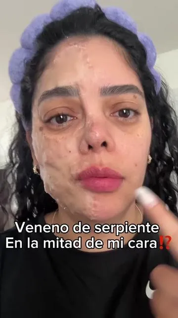 Como me quedó la piel después de esto es como si me hubiese hecho algún procedimiento estético solo que mucho más económico #skincare #skincareroutine #tiktokshopholidayhaul #tiktokshopholidaydeals #peptide 