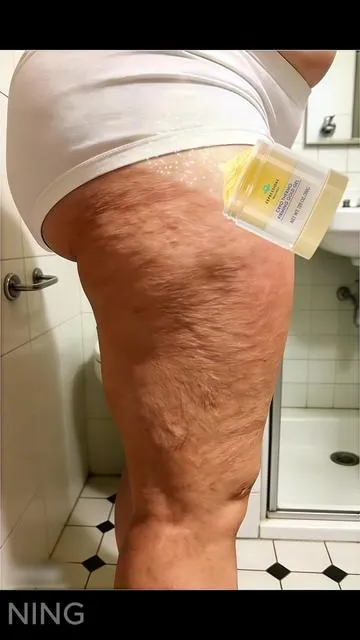 If you want smoother more confident legs, TRUST ME TRY THIS!#cellulite #TikTokShopHolidayHaul #ShopVideoCarnival #skintightening #gold 