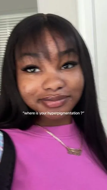 the difference is altering my brain chemistry 🤯 #fyp #kbeauty #hyperpigmentation #viral #darkspotremoval 