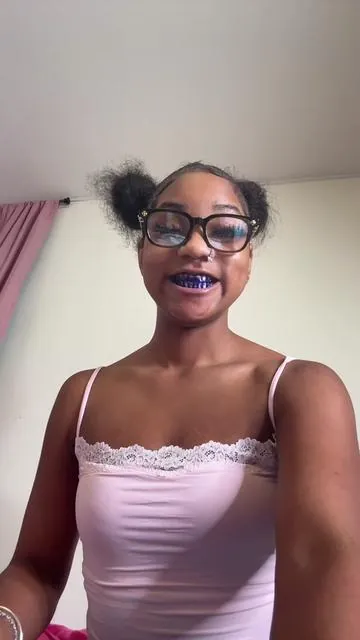 How much for teeth like this ?????