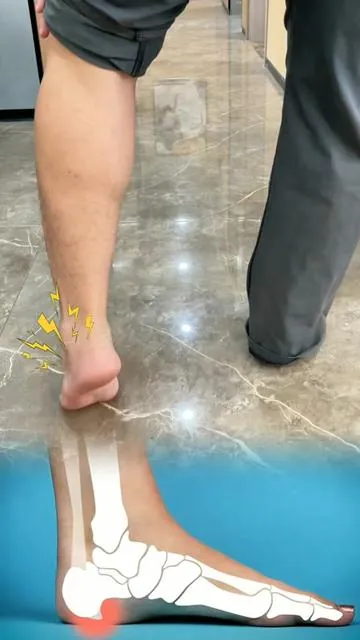 Gel analgésico para doloresmusculares, articulares, de espalda,etc.#painrelief#jointpain#arthritisrelief#inflammationrelief#tiktokmademebuyit 