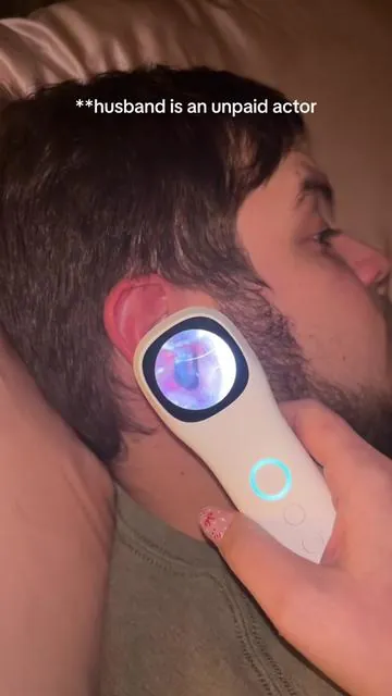 This is such a cool find and now I’m obsessed with looking in ears 🫣 #earcamera #earwax #earwaxremoval #otoscope 