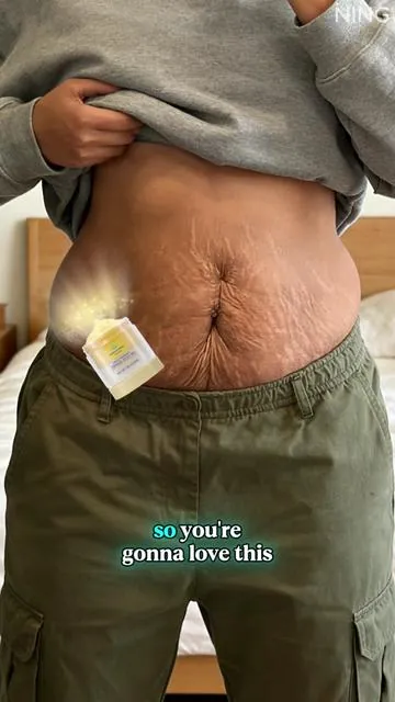 I frickn love this shit for my cellulite and stretch marks! #cellulite #stretchmarks #massageoil #tiktokshopholidayhaul #ShopVideoCarnival 