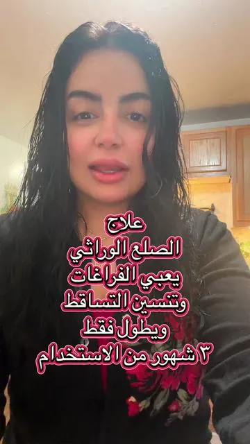#tiktokshop #fypシ゚viral #fyp #baghdad #erbil 