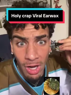 This is a MUST have😮‍💨😳#viral #tiktokmademebuyit #removal #earwaxremoval #gloves 