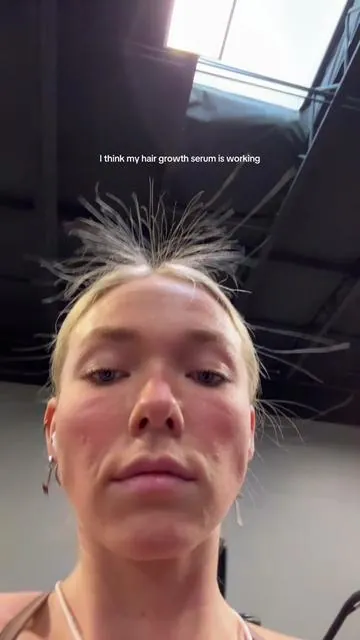 I’m as shocked as you are 😭🙌🏼 #hairgrowth #hairtok #hairserum 