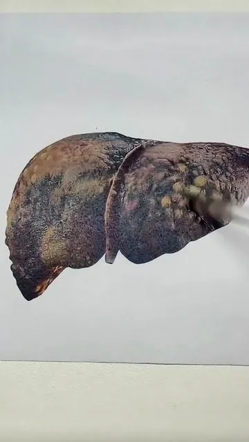 #fyp #health #selfcare #liver 