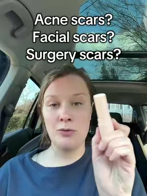 Scars don’t fade overnight- but this is the one thing I know will get the job done faster ✨ #siliconescar #scartreatment #tiktokshopcreatorpicks #tiktokshopholidayhaul #prequel 
