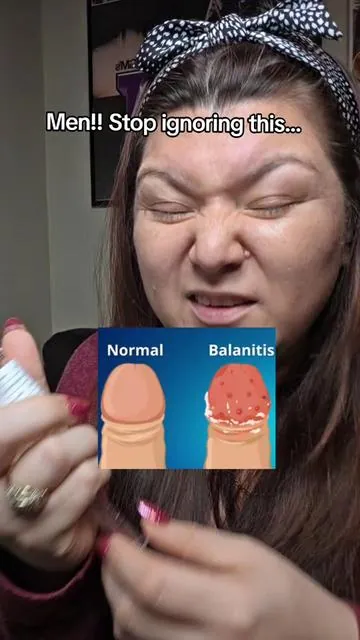 #hermonbalanitisreliefkit #balanitis #balanitisrelief 