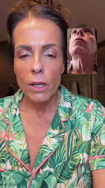 Firm, smooth, and lift your neck with this 3‑step regimen — a targeted routine that helps tackle sagging, texture, and loss of elasticity for a defined, brighter neck area. #tiktokshopjumpstartsale #tiktokshopfinds #tiktokshopcreatorpicks #skincaretips #newyearnewme  @Dr.Melaxin Global 