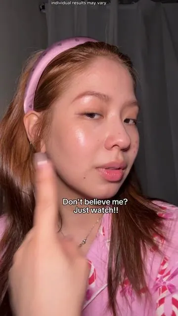 Don't believe me? Just watch!👀 My holy drying lotion🤍#acnetreatment #skincare #salicylicacid #acne #drleodryinglotion 