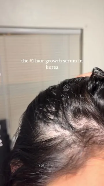 korea’s no.1 hair growth serum for a reason!! finally a product that ACTUALLY shows results… non-greasy, no rinsing, and on sale rn! #lilyeve #growturn #hairgrowth #hairtok #tiktokshopcreatorpicks @LILYEVE GLOBAL 