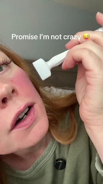 Well I might be crazy. But not about this. #microneedlingface #microneedlingathome #dermastamp 