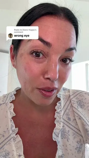 Replying to @Diane Happy same eye 🥹🙏🏽 @ForChics #LashSerum #eyelashes #eyelashserum #lashserum #ForChics 