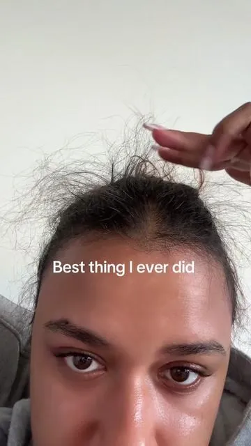 #hairshedding #thinninghair #healthyhairtips #tiktokshopcreatorpicks #tiktokshopjumpstartsale 