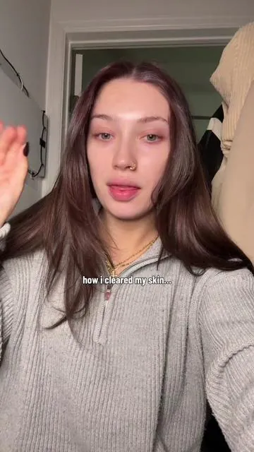 How i cleared my skin!! lmk if you want me to a more detailed vid on yt & im more than glad too 🫶🏼🫶🏼  #evaamarieee_ #fyp #skincare #koreanskincare 