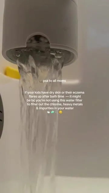 As a mom this has been a game changer for my babies sensitive skin & eczema — we have noticed such a difference ✨ HIGHLY recommend this Canopy bath water filter! They come in the cutest colors too!!@GetCanopy #babybathfilter #babyessentials #eczemarelief #firsttimemomtips #momhack  
