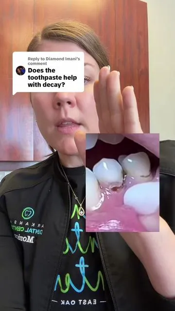 Replying to @Diamond Imani I hope this helps and I also hope you keep from getting scammed. This is an amazing toothpaste but for some things you will simply have to go see your dentist. #TikTokShopCreatorPicks #toothpaste #nanohydroxyapatite #besttoothpaste #fyp @Thebentist 