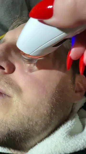 I can’t believe how well this blackhead remover works from @Valer Boutique. #valerboutique #blackheadextractor #blackhead #blackheadvaccum #blackheadremover 