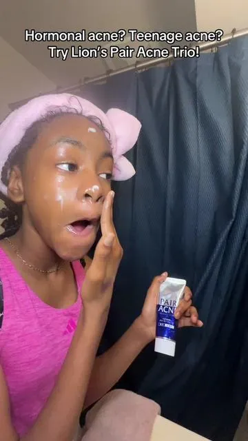 My preteen had hormonal acne but lately she just brags about how her skin cleared up lol. I’m like girl bye! #hormonalacne #acne #clearskin #teen #fyp 