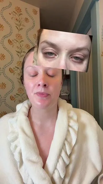 Hands down my holy grail product for under eye bags, the hollowness, the dark circles- everything. I love this duo SO MUCH. #drmelaxin #cemenrete #darkcircles #undereyebags #darkcirclefix 