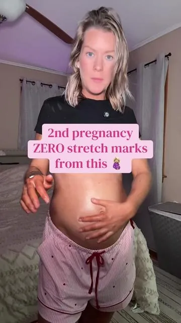 Pregnant mamas do not sleep on the belly care! You get the serum to moisturize and the balm to really hydrate and lock it all in. I swear by this after having zero stretch marks my first pregnancy #stretchmarks #pregnancy 