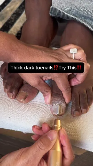 Replying to @💭💞Kay Kay😊✨ Try using nail drill! I love this one from @COSLUS.USA  #toenailcare #thicknails #yellowtoenails #coslusnaildrill #darktoenails  