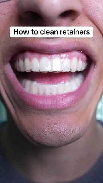 It’s soo easy!  #viral #fyp #teethwhitening #braces #TikTokShopCreatorPicks 