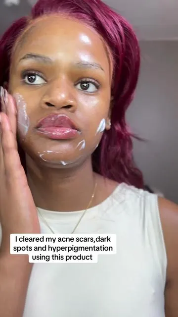 I swear by this arbutin cream 💯 #mariaruth1 #skincare #darkspots #hyperpigmentation #arbutin 