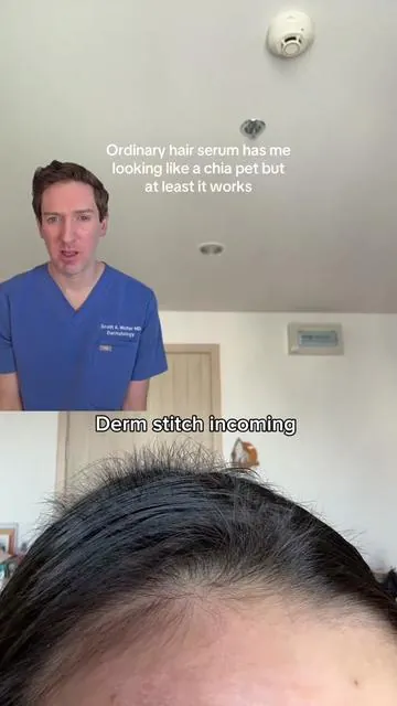 Stitch w/@rennajomano  Is the viral Ordinary Peptide Hair Serum worth it? I'd still use topical minoxidil over this any day but I think this could be a good compliment to any hair loss routine. #hairloss #ordinaryhairserum #alopecia #derm #hairserum 