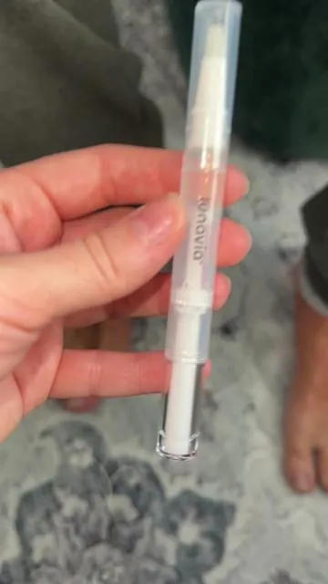 his nails look so so much better so if you get any type of fungus or infection, definitely try this out because it looks like it’s help a ton  #fingernails #nailfungustreatment #nailfungus #nails #nailtreatment  