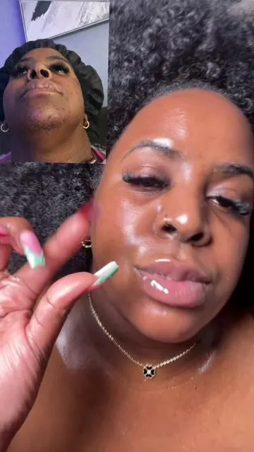 Designed for those with PCOS who struggle with dark spots, uneven tone, and stubborn discoloration. Gently exfoliates and supports a brighter, more even-looking complexion. #discoloration #hyperpigmentation #pcosawareness #PCOS #hormonal @medicube global 