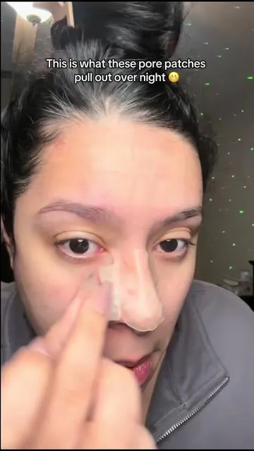 These pore-clearing hydrocolloid nose patches are designed to fit the shape of your nose while gently absorbing excess oil and buildup. They come in multiple sizes to target different areas and blemishes, making them perfect for overnight use or pre-makeup prep. Easy to apply, gentle on sensitive skin, and ideal for busy routines when you want clearer-looking skin with minimal effort. #TKTK #pimplepatch #hydrocolloid #blackheadremoval #skincareroutine 