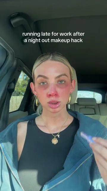no filtet, no cuts, no lights. Just a concealer in the car #concealer #concealerhack #tarteshapetape 