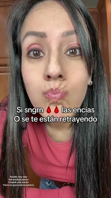 7603087323915504927