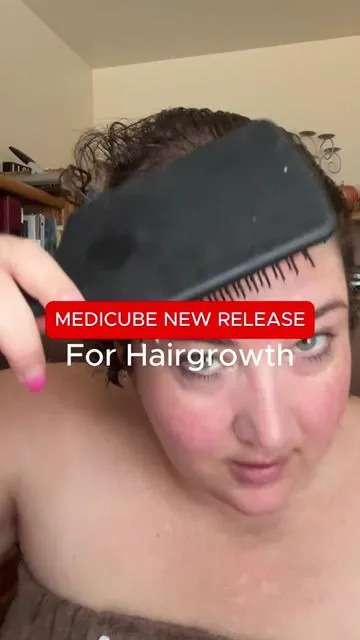 Hair loss that no one warned you about — until it’s happening to you #hairlosswomen #androgenicalopecia #thinninghair #scalphealth @medicube global 