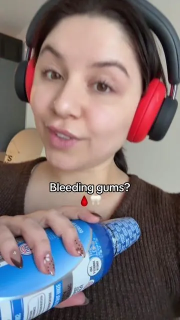 Let’s help those bleeding gums! I’m so excited about the therapeutic line from Gurunanda !!! This rinse is specifically made to help gingivitis. As a dental hygienist I’m really excited about this. #bleedinggums #gingivitis #gumdisease #dentalhygienist #tiktokshopcreatorpicks 